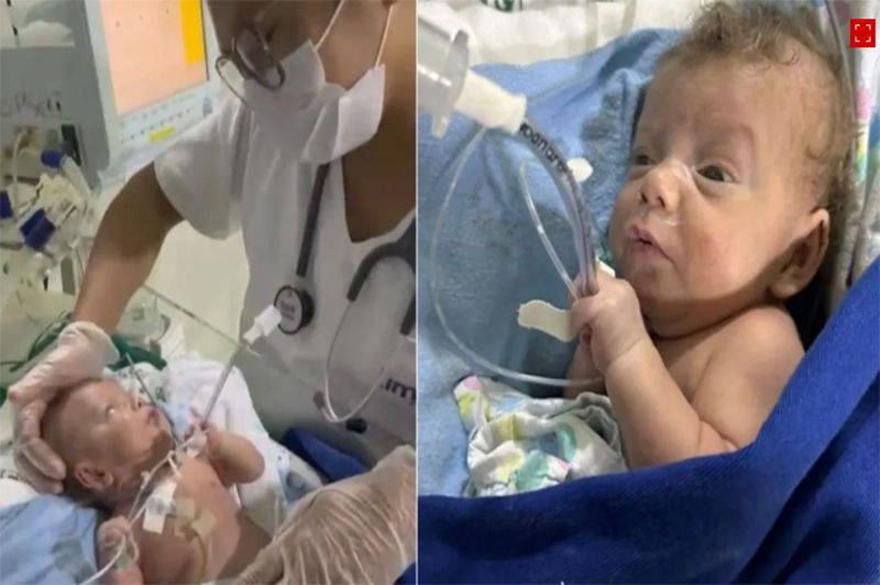 Bebê prematuro extremo recebe alta após seis meses em UTI em Macapá